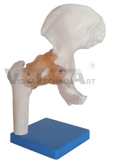 Life Size Hip Joint Pharmaceutical and Anatomical Model Gifts